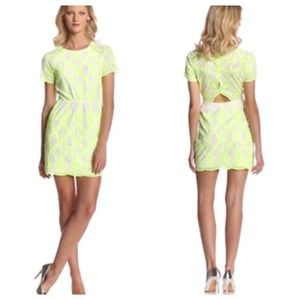 Dolce Vita open back dress